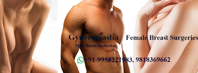 breast augmentation in india, mastopexy in delhi, best gynecomastia surgeon in india, best plastic surgeon in Delhi, gynecomastia surgery in delhi, #gynecomastia,  #breastaugmentation, #breastlift, #breastreduction, #breastsurgerycost